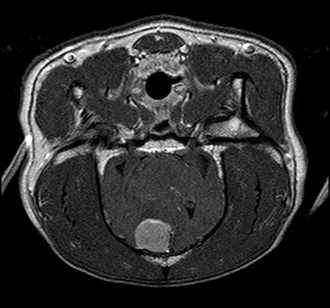 Axial view of a brain tumor in a dog; it was successfully removed