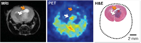 At left, an MRI scan of a DIPG tumor in a mouse model. The orange arrow points to contrast agent signal accumulation, not tumor. The tumor appears below that, much less clearly (white arrow). At center is a PET/CT scan image of the same mouse, created after injection with the fluorescent agent. In this image the tumor is clearly delineated. At right is a microscopic histology image of a slice of that same mouse brain confirming extent and location of the tumor. 