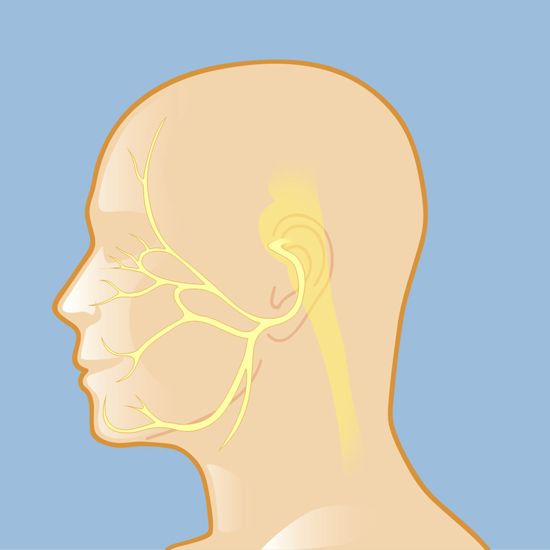 Hemifacial Spasm Weill Cornell Brain And Spine Center