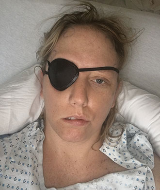 Keri Mahe wore an eye patch at first after surgery to repair her cavernous malformation