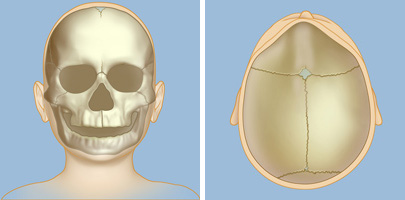 metopic synostosis craniosynostosis suture symptoms nose which center spine caused fusing extends illustrations these weillcornellbrainandspine
