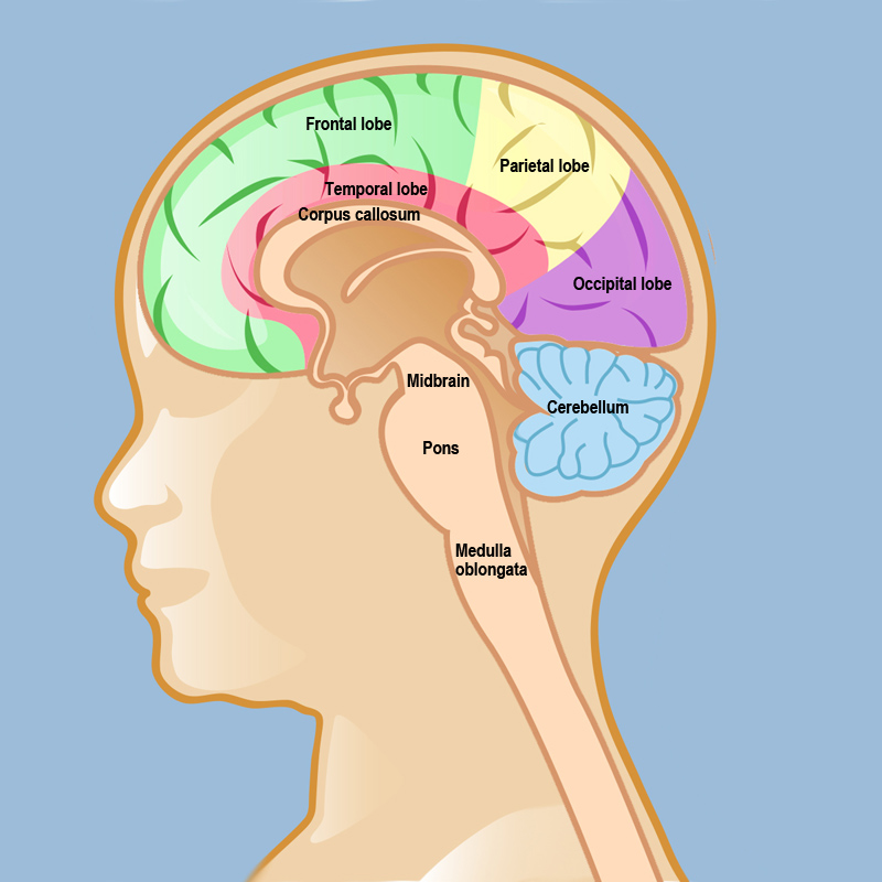 Glioma Brainstem Glioma In Adults