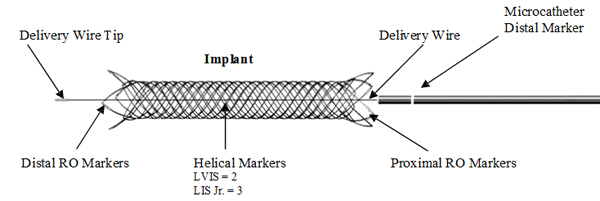 LVIS stent device