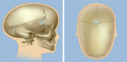 abnormal head shapes