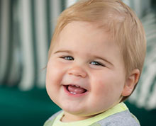 Leo today is a happy and healthy toddler, with a perfect shaped head