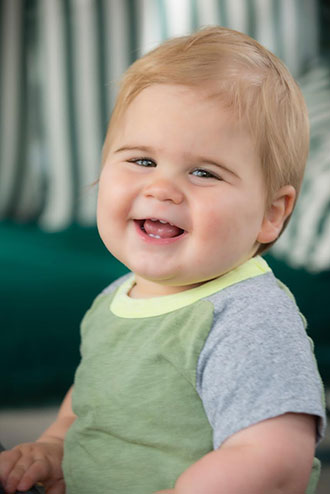 Leo today is a happy and healthy toddler, with a perfect shaped head