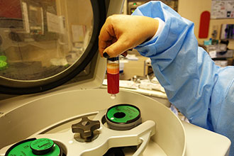  Adipose tissue being centrifuged in the OR in preparation for injection