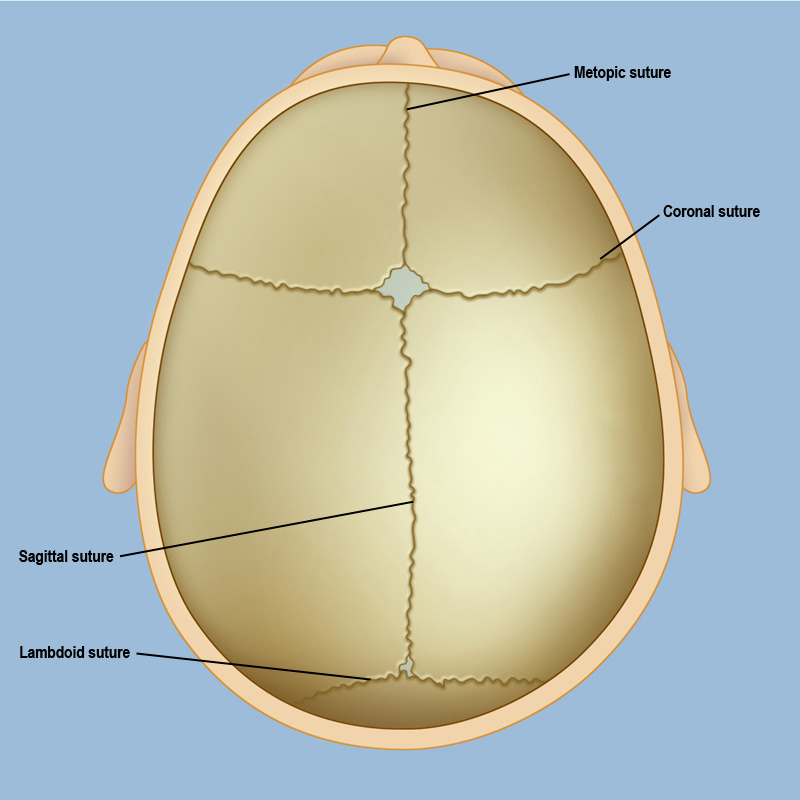 Craniosynostosis Weill Cornell Brain And Spine Center