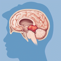 Surgery for Germ Cell Tumors in the Brain | Brain & Spine Center