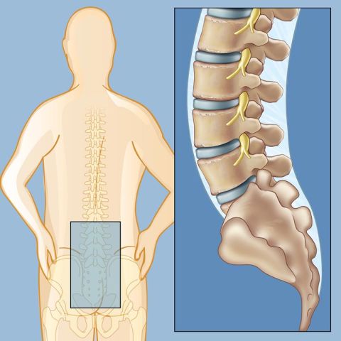 Lower Back Pain