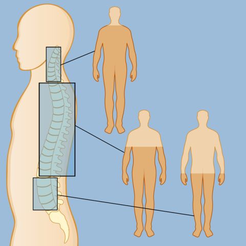Spinal cord injury