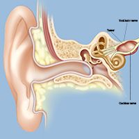 Acoustic Neuroma acoustic neuroma location diagram