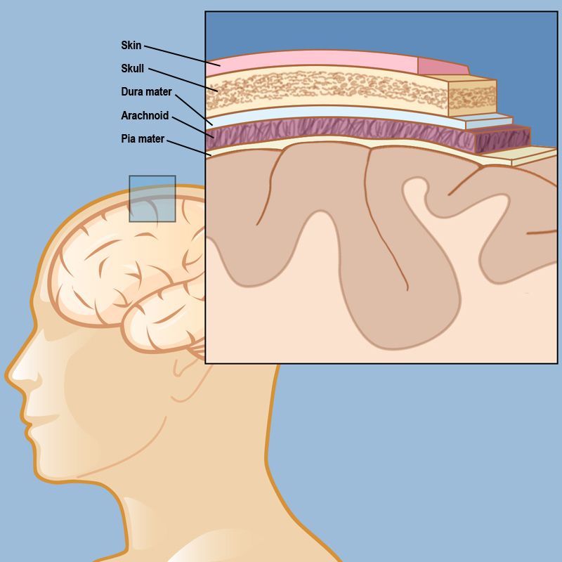 A meningioma forms in the meninges, which consist of the dura mater, the arachnoid membrane, and the pia mater, which lie directly below the skin and skull.
