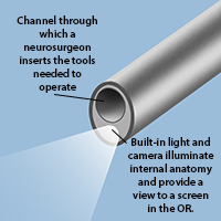 endoscope diagram