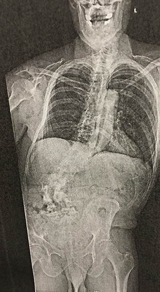 Jeff's x-ray Jeff's x-ray