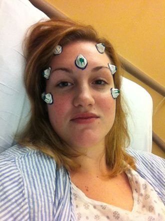 Here I am right before the surgery, with MRI markers in place. The markers are used to create a spatial map of the tumor using a computer in the operating room. You can probably tell from this photo that I wasn't feeling great.