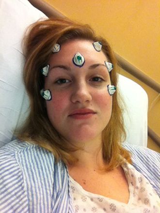 Here I am right before the surgery, with MRI markers in place. The markers are used to create a spatial map of the tumor using a computer in the operating room. You can probably tell from this photo that I wasn't feeling great. Here I am right before the surgery, with MRI markers in place. The markers are used to create a spatial map of the tumor using a computer in the operating room. You can probably tell from this photo that I wasn't feeling great.
