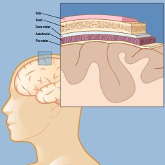 A meningioma forms in the meninges, the layers of the dura