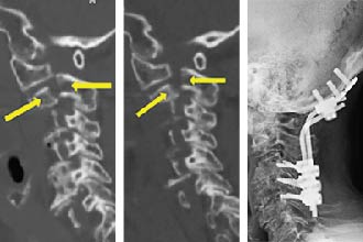 Tryptich of x-ray scans